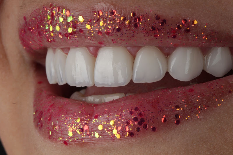 Foto 4 de Implant'Art Clínica Odontológica Macaé