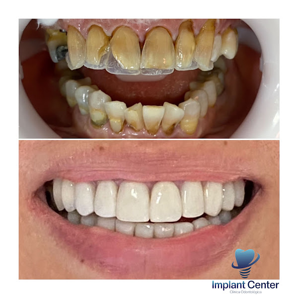 Foto 3 de Implant Center Odontologia Reabilitadora e Estética