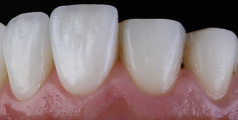 Foto 3 de IMPLANTAR ODONTOLOGIA