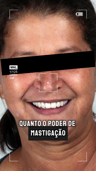 Foto 4 de Implantar Odontologia - Brasília