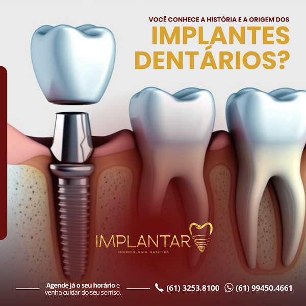 Foto 3 de Implantar Odontologia Estética