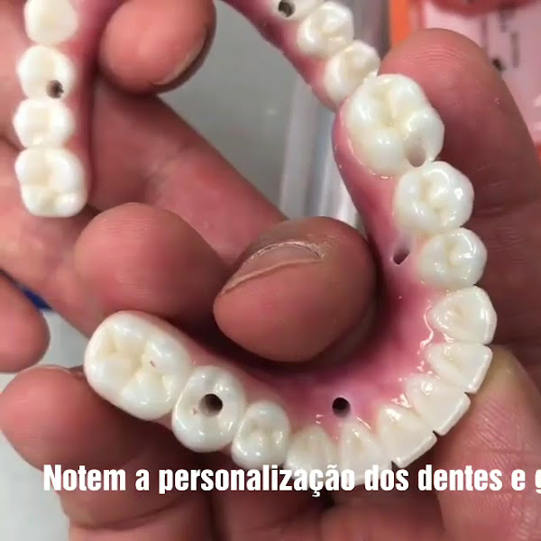 Foto 3 de Implantare