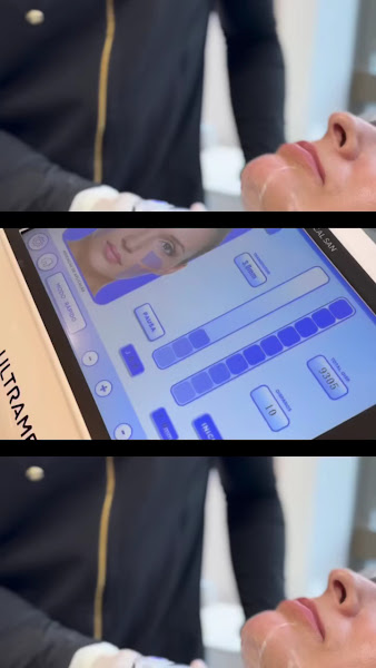 Foto 3 de Implante Clinic - Botox - Implantes Dentários - Harmonização Facial - Goiânia