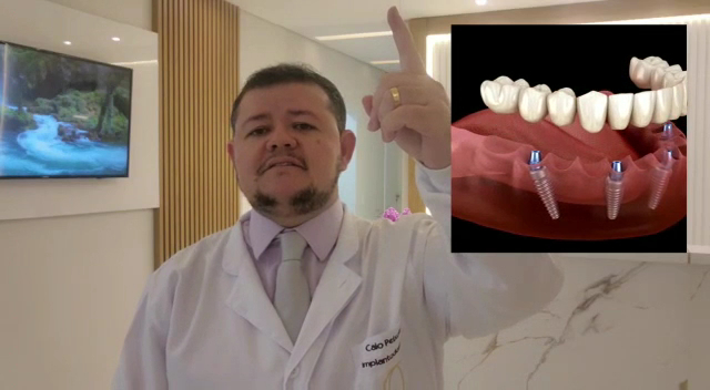 Foto 4 de Implante Dental Campinas