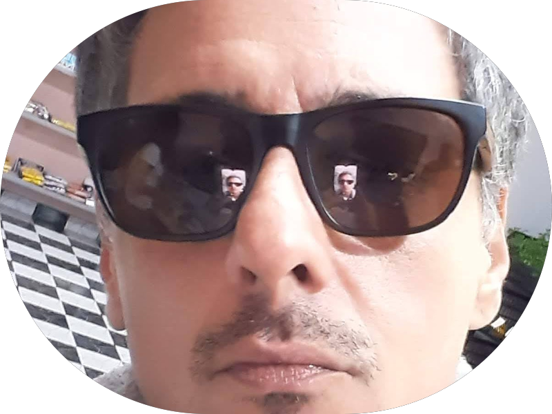 Foto 6 de Implante Dentário | Dentista no Tucuruvi | Oral Angels | Dr. Luis Eid