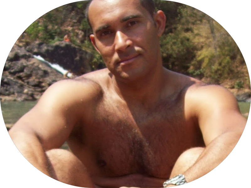 Foto 5 de Implante Dentário em Ceilândia | Dentista | Ideal Odontologia