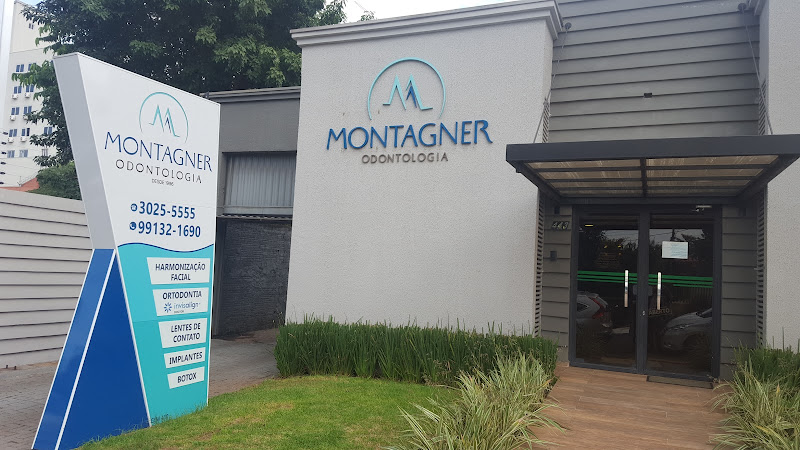 Foto 3 de Implante Dentário | Invisalign | Montagner Odontologia | Centro | Foz do Iguaçu - PR