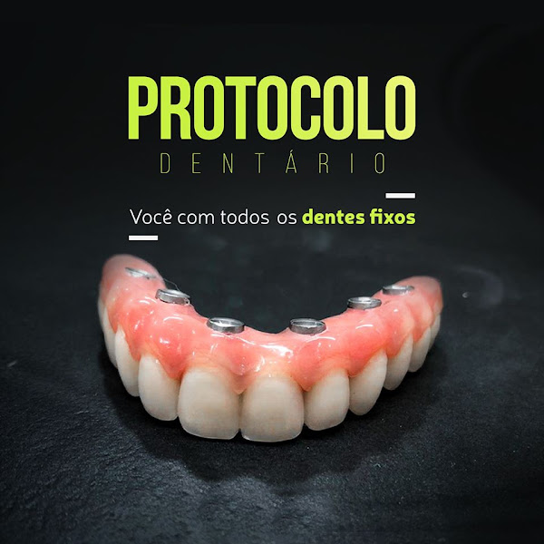 Foto 3 de Implante Dentário | Lentes Em Resina | Oral Blue São Benedito | Uberaba - MG