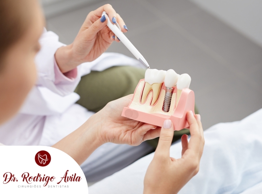 Foto 3 de Implante Dentario, Protese Dental, Dentista, Dr Rodrigo Ávila, Volta Redonda