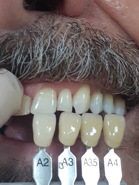 Foto 3 de Implante & Dente