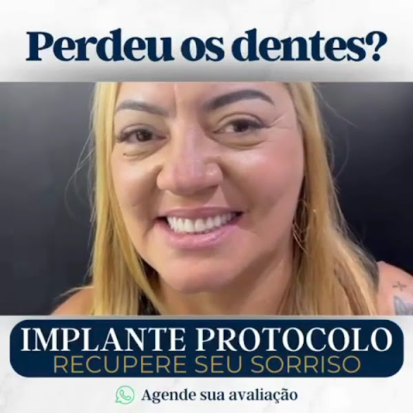 Foto 4 de Implante Prótese tipo Protocolo - Madureira - Rio de Janeiro