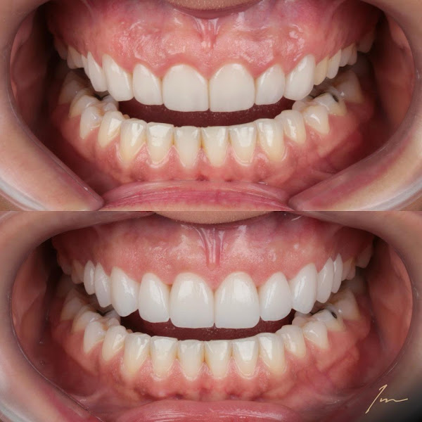 Foto 2 de Implantec Odontologia