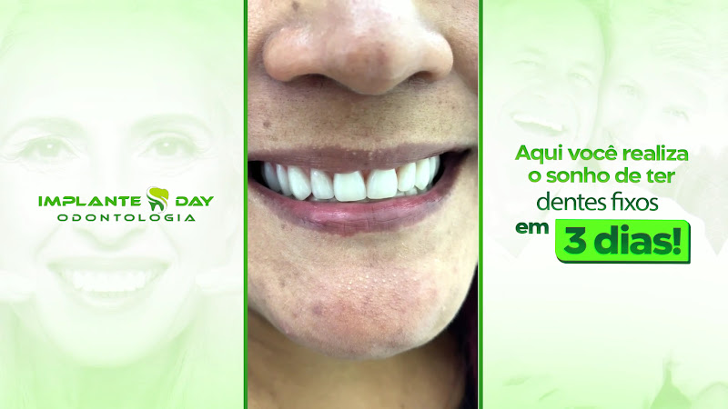 Foto 3 de Implantes Day Sumaré