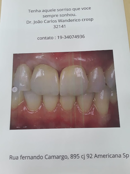 Foto 2 de Implantes dentais