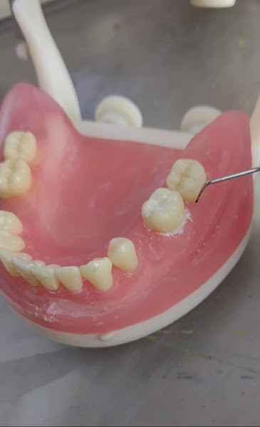 Foto 3 de Implantes dentais