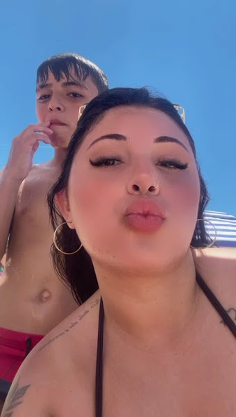 Foto 2 de Implantes Dentários