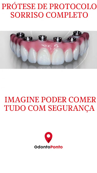 Foto 4 de Implantes Dentários | Aparelho Dentário | Dentista | OdontoPonto | Guaianazes, Guaianases Vila Minerva - SP