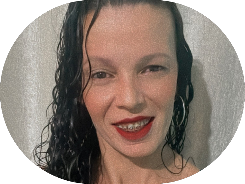 Foto 7 de Implantes Dentários | Aparelho Dentário | Dentista | OdontoPonto | Guaianazes, Guaianases Vila Minerva - SP