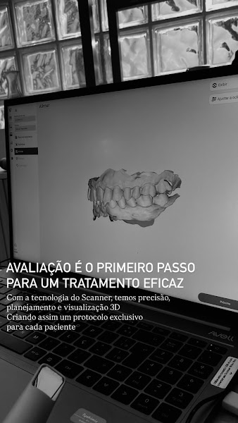 Foto 3 de Implantes dentários | Dentista | Artimplan Odontologia | Zona Norte