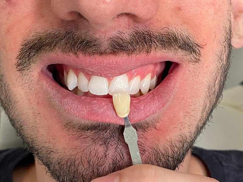 Foto 6 de Implantes dentários | Dentista | Artimplan Odontologia | Zona Norte