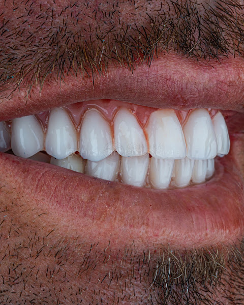 Foto 2 de Implantes Dentários | Dentista | Clínica Coimbra Odontologia | Nova Iguaçu RJ