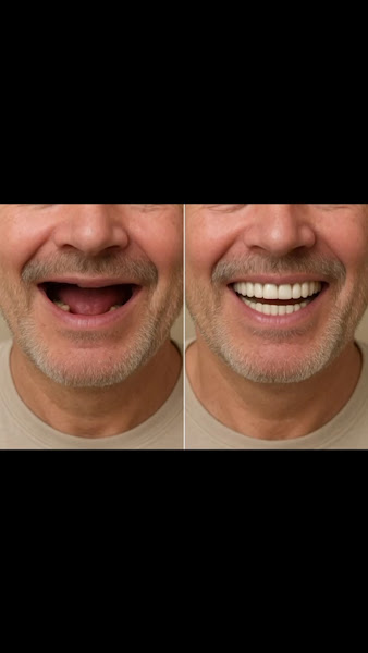 Foto 3 de Implantes Dentários | Dentista | Clinica Odontológica Belo Sorriso | Vilhena RO