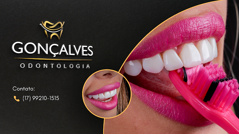Foto 2 de Implantes Dentários | Dentista | Gonçalves Odontologia | São José do Rio Preto - SP
