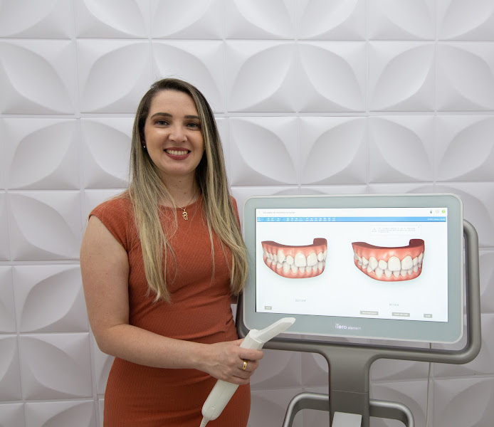 Foto 3 de Implantes Dentários | Dentista | Odonto Schoba | Piracicaba - SP