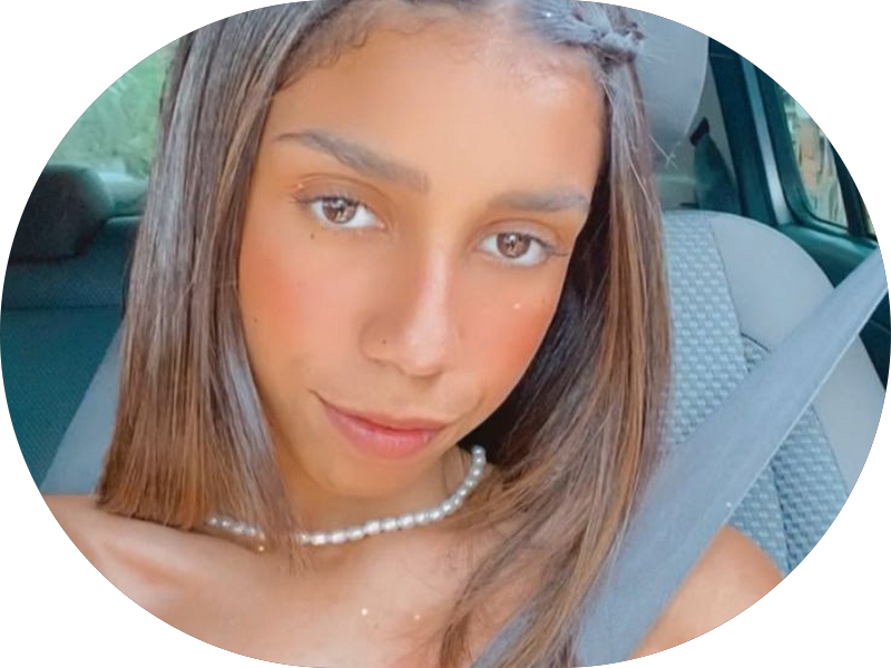 Foto 5 de Implantes Dentários | Dentista | Toyomoto Odontologia | Vila Mascote SP