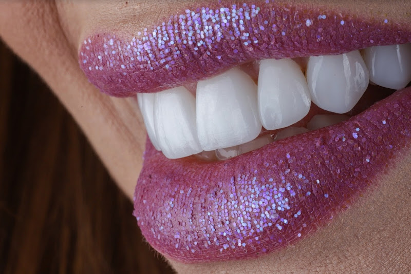 Foto 2 de Implantes Dentários - Dr. Lucas Lucena