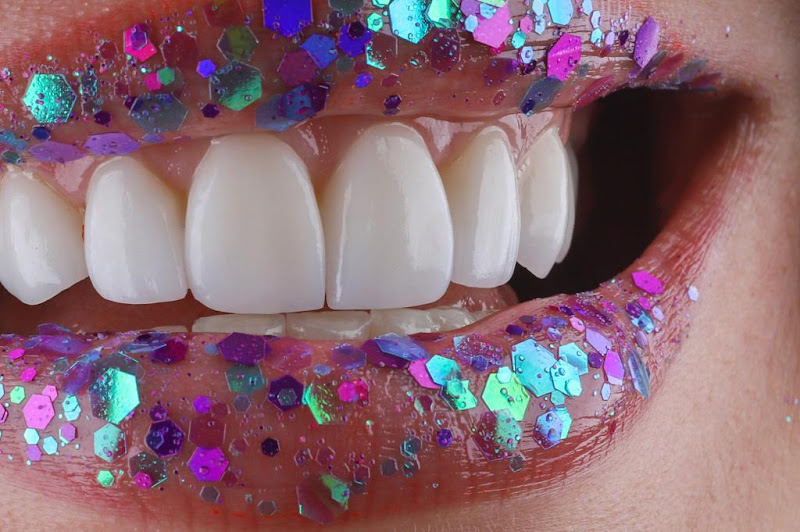 Foto 3 de Implantes Dentários - Dr. Lucas Lucena