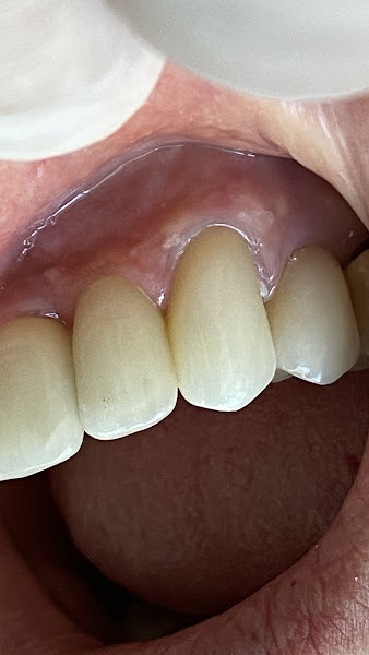 Foto 3 de Implantes Dentários - Dr. Victor Petrin - Dentista