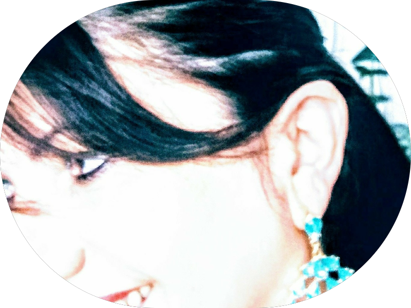 Foto 7 de Implantes Dentários em Aldeota, Fortaleza - Sorridents