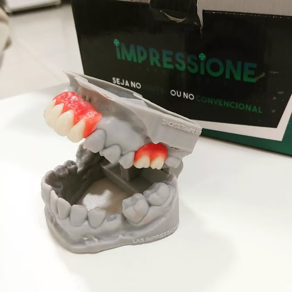 Foto 3 de Implantes Dentários em Fortaleza - Dr. Vinícius Marques