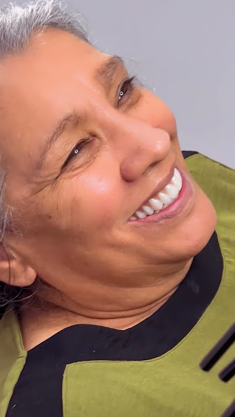 Foto 4 de Implantes Dentários em Guarulhos | Useodonto - instituto odontológico em Guarulhos