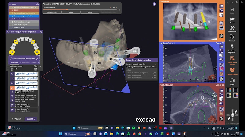 Foto 3 de Implantes Dentários Felipe Pohlmann