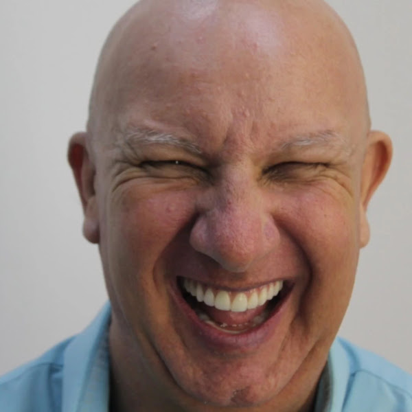 Foto 4 de Implantes Dentários | Próteses Fixas | Lima Clínica Odontológica Dentista em Bauru