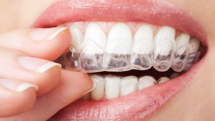Foto 2 de Implantes Dentista Ferraz de Vasconcelos