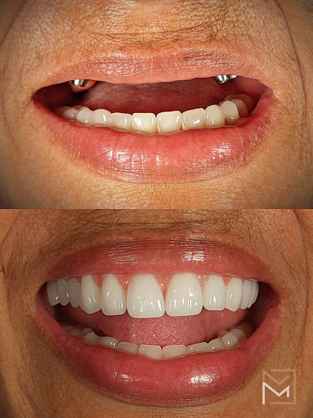 Foto 3 de IMPLANTES E PROTESE MANAUS