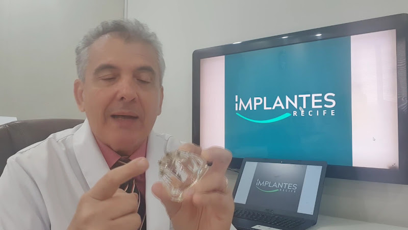 Foto 3 de Implantes em Recife