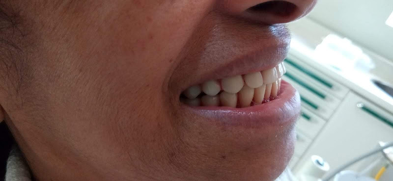 Foto 2 de Implantes Jabaquara