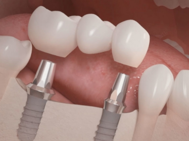 Foto de ImplantEXS - Eduardo Xavier - Dentista