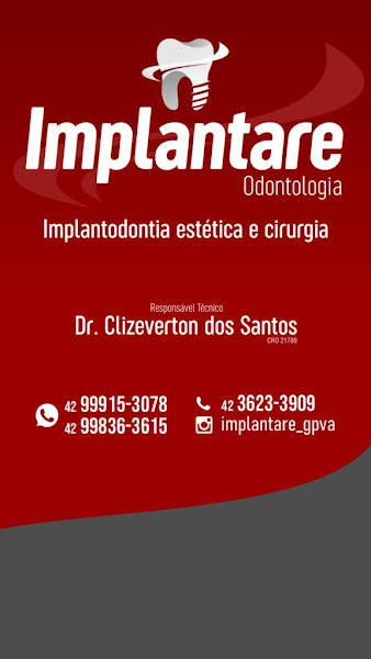 Foto 2 de Implanthar Clinica Odontologia - Dr Clizeverton dos Santos