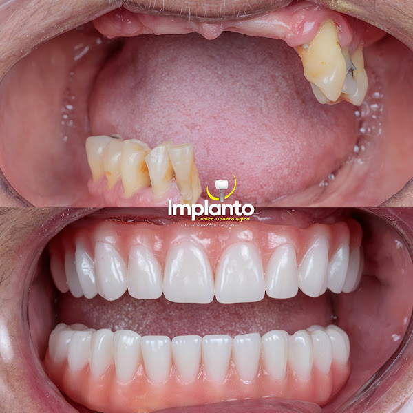 Foto 3 de Implanto Clínica Odontológica