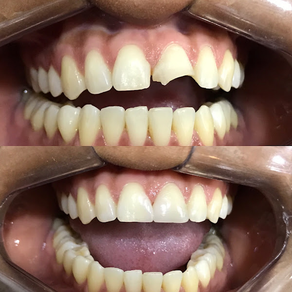 Foto 3 de Implanto Odontologia