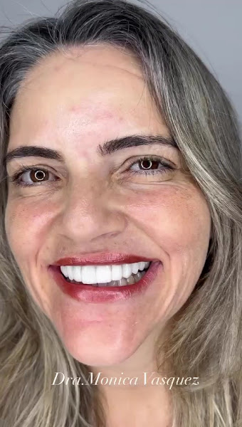 Foto 3 de Implantodontia e Reabilitação Oral