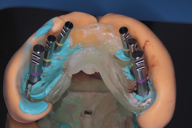 Foto 3 de Implantodontista Dr Roberto Yamachita Oliveras