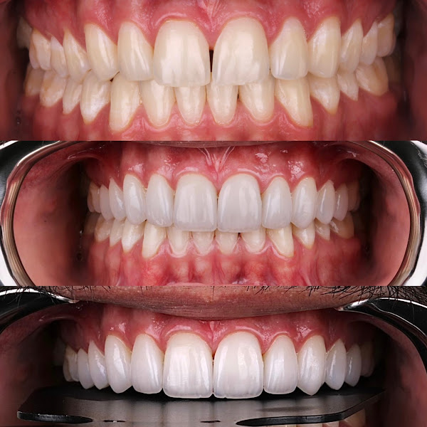 Foto 2 de Implantologia Oral Dr. Aurélio da Costa Pires