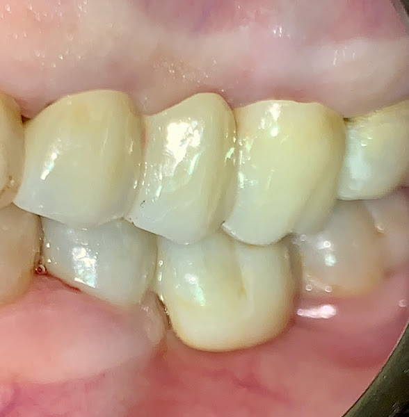 Foto 3 de Implantologia Oral Dr. Aurélio da Costa Pires