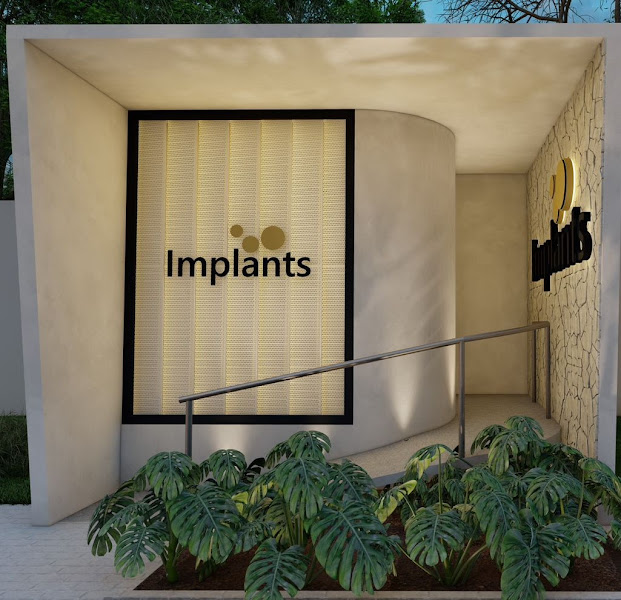 Foto 2 de Implants Clínica Odontológica